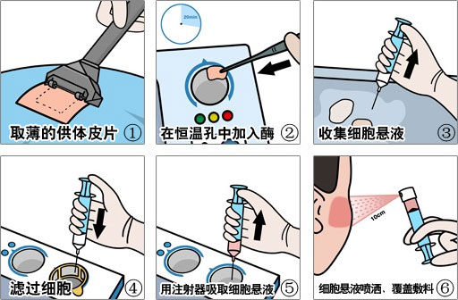 分型分诊,多维治疗黑色素细胞自体体外再生术.jpg