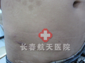 康复.png